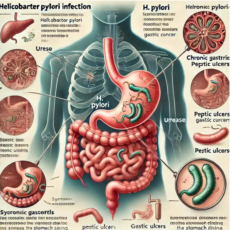 Il test dell'H. Pylori diventa semplice: la soluzione per una diagnosi rapida e affidabile